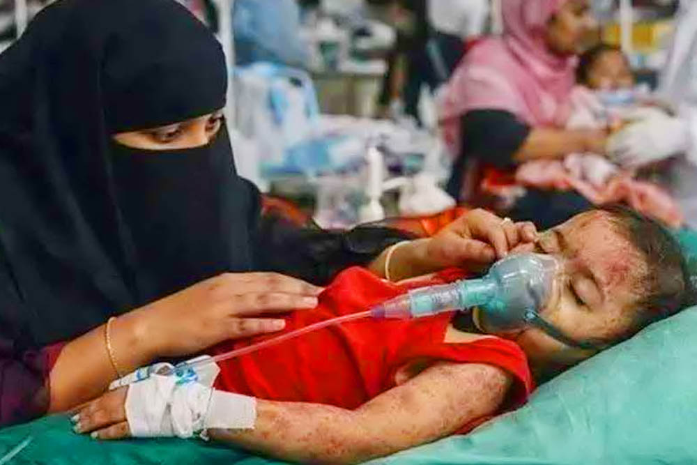 হাম ও হামের উপসর্গ নিয়ে আরও ৮ শিশুর মৃত্যু