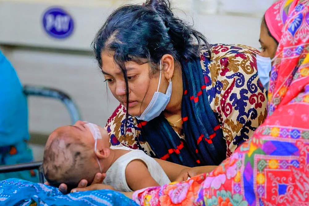 হাম ও হামের উপসর্গে শিশুর মৃত্যু ৫০০ ছাড়াল